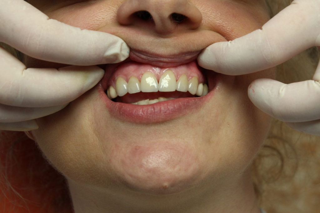 Dentum